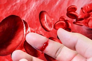 هموفیلی را بیشتر بشناسیم، از علائم تا کنترل بیماری